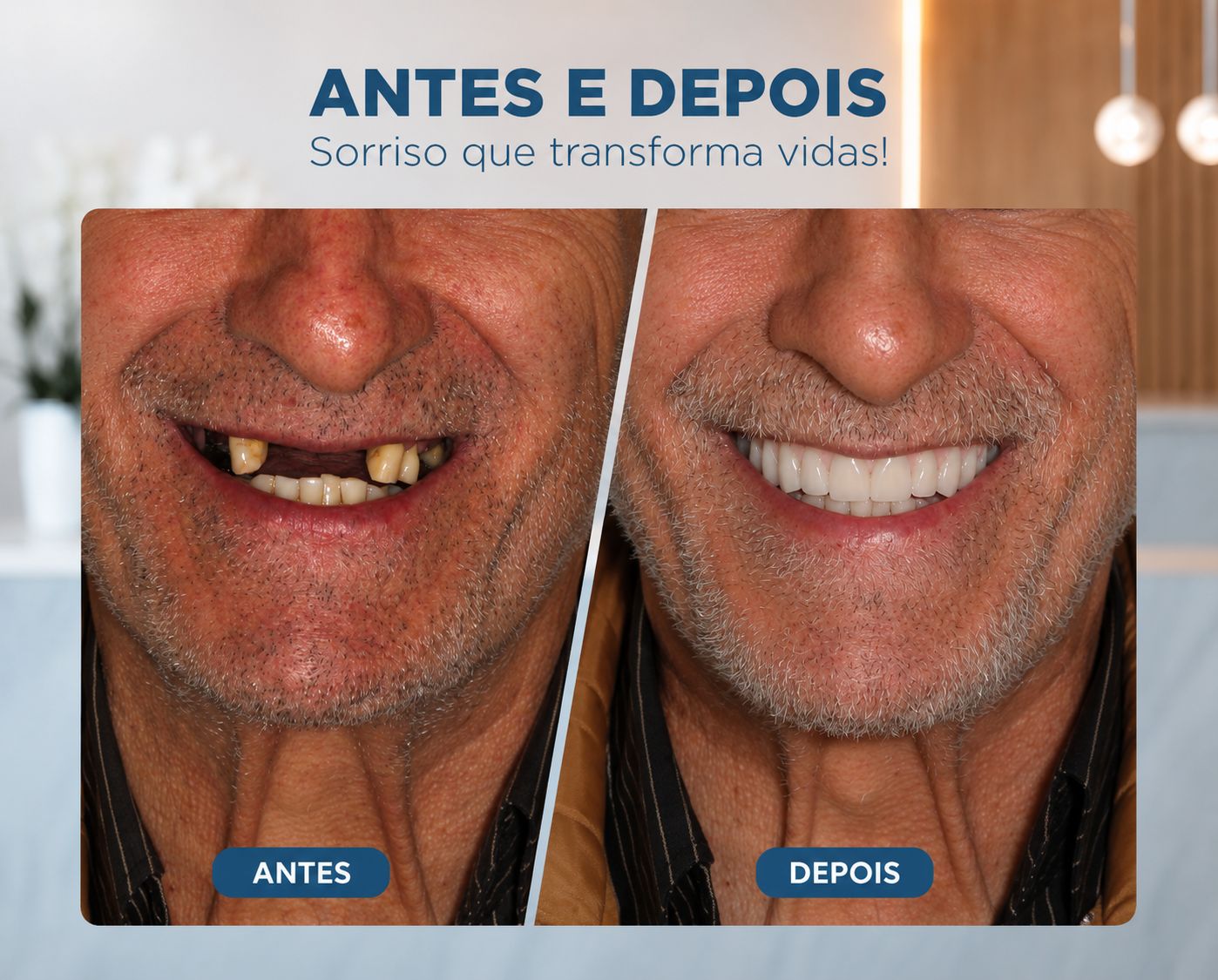 resultados reais implantes dentarios