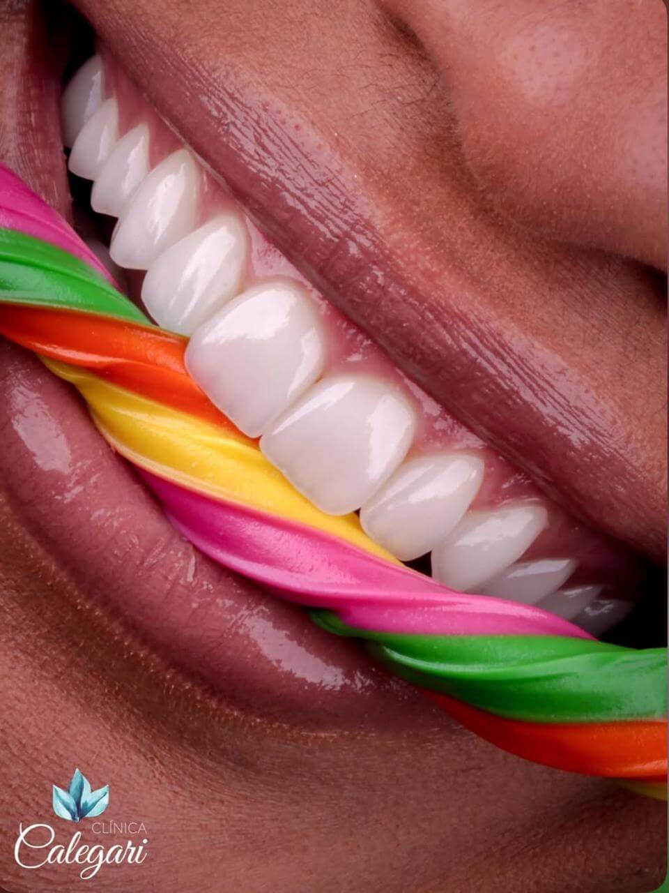 resultados reais 10 implantes dentarios